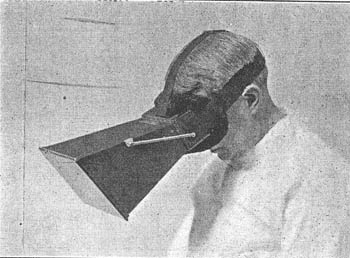 Wolf X-Ray Products Operating Fluoroscope (ca. 1930s)