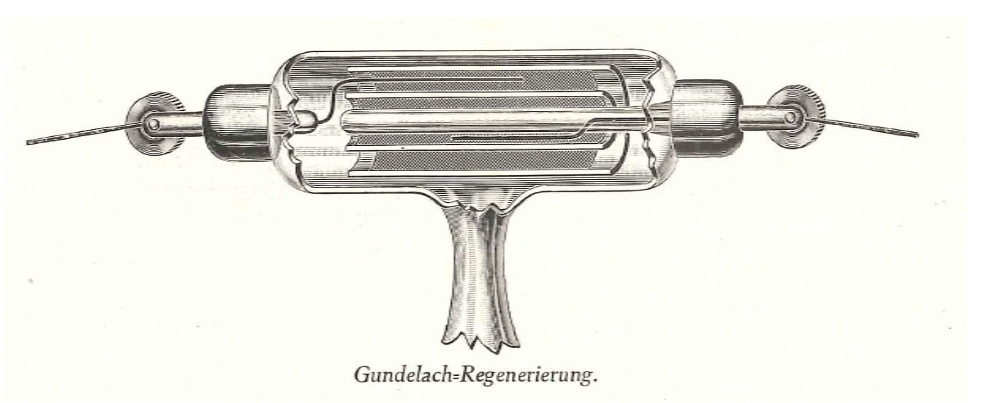 Gundelach "Moment" X-Ray Tube (1912-1920)
