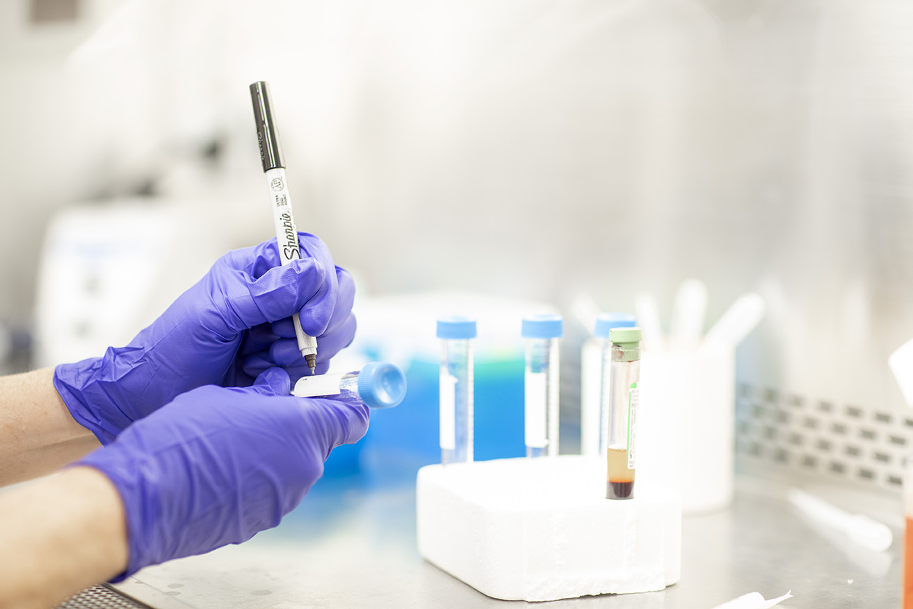 A laboratory technician labels a blood sample